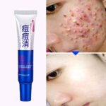 BIOAQUA Pure Skin Acne Rejuvenation Cream – Crème anti-acné visage 30 g