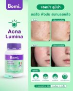 Bomi Acna Lumina 30 gélules pour réduire l acné et retrouver une peau nette – Image 2