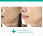 Smooth E Face Lift Exteral Capsules 12 caps – Image 3