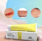 X Pert Nettle Gel 20 g – Image 3