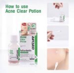 Oxe Cure Acne Clear Potion 15 ml – Image 2