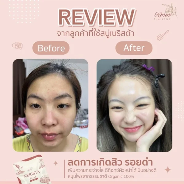 Nerista Cleansing Gel + Nerista Soap – Image 3