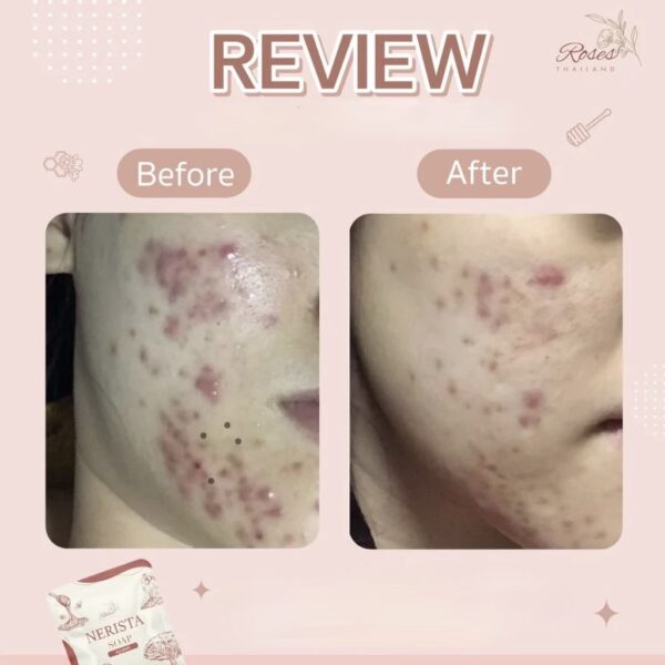 Nerista Cleansing Gel + Nerista Soap – Image 2