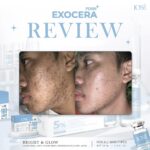 Jose Exocera Booster Ampoule 15 ml – Image 3