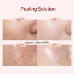 Glad2Glow AHA BHA PHA Intensive Peeling Solution Serum – Image 8