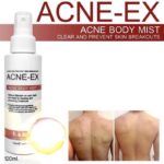 ACNE-EX Body Mist 120 ml – Image 6