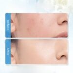 Glad2Glow Tremella Vita B5 Sensitive Calming Moisturizer – Crème Hydratante Apaisante Peaux Sensibles 30 g – Image 4
