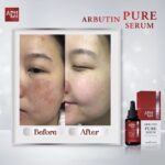 APH Alpha Arbutin Pure Serum – Éclat Anti-Taches à l'Alpha-Arbutine 15 ml – Image 3