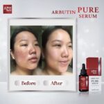 APH Alpha Arbutin Pure Serum – Éclat Anti-Taches à l'Alpha-Arbutine 15 ml – Image 2