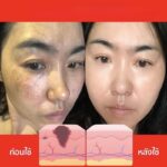 Sérum visage anti-taches à l’alpha-arbutine et vitamine C – Minnise Arbutin C+ – Image 5